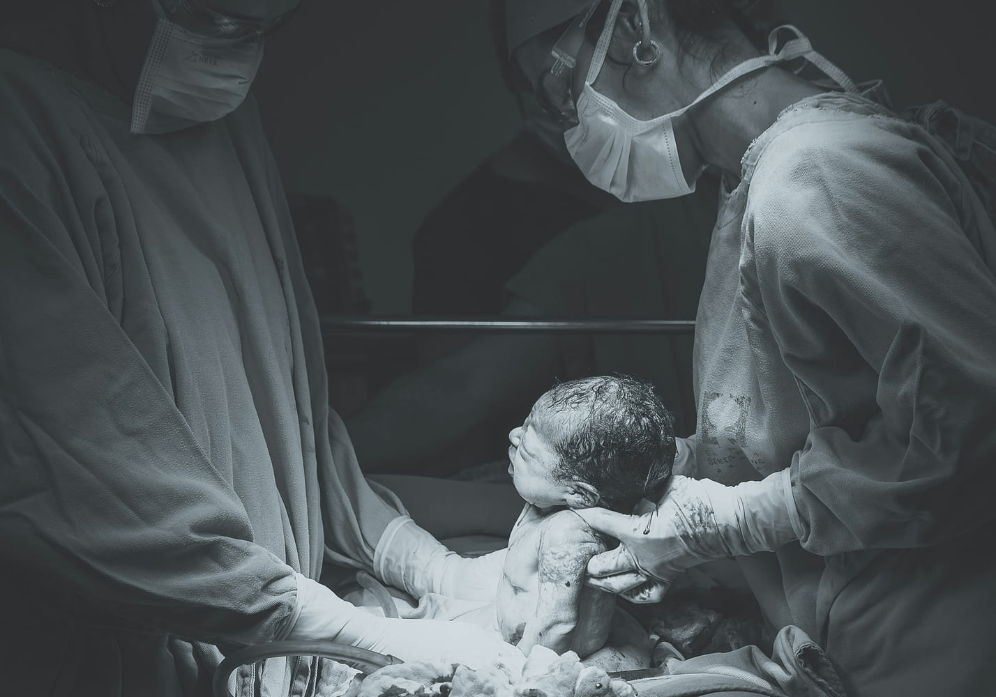 AVAC : tout savoir sur l&rsquo;accouchement vaginal après césarienne