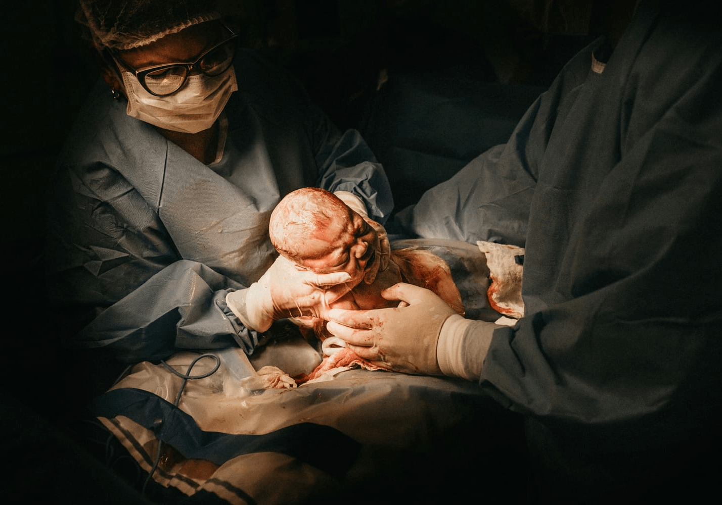 Bien préparer une césarienne : reprendre son pouvoir