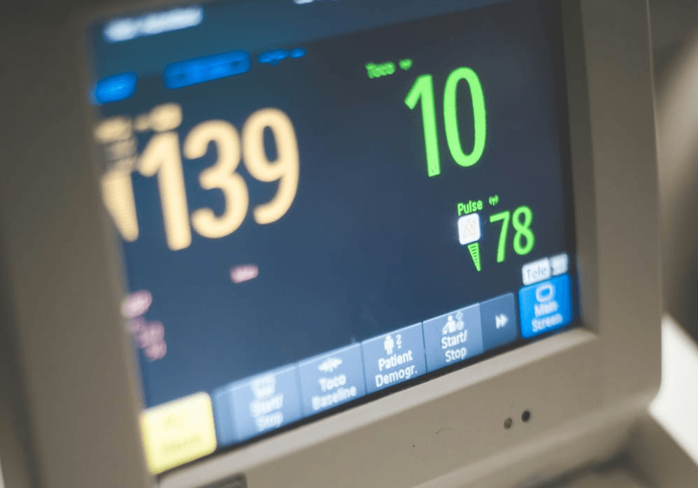 Le monitoring continu pendant l&rsquo;accouchement : ce qu&rsquo;il faut savoir