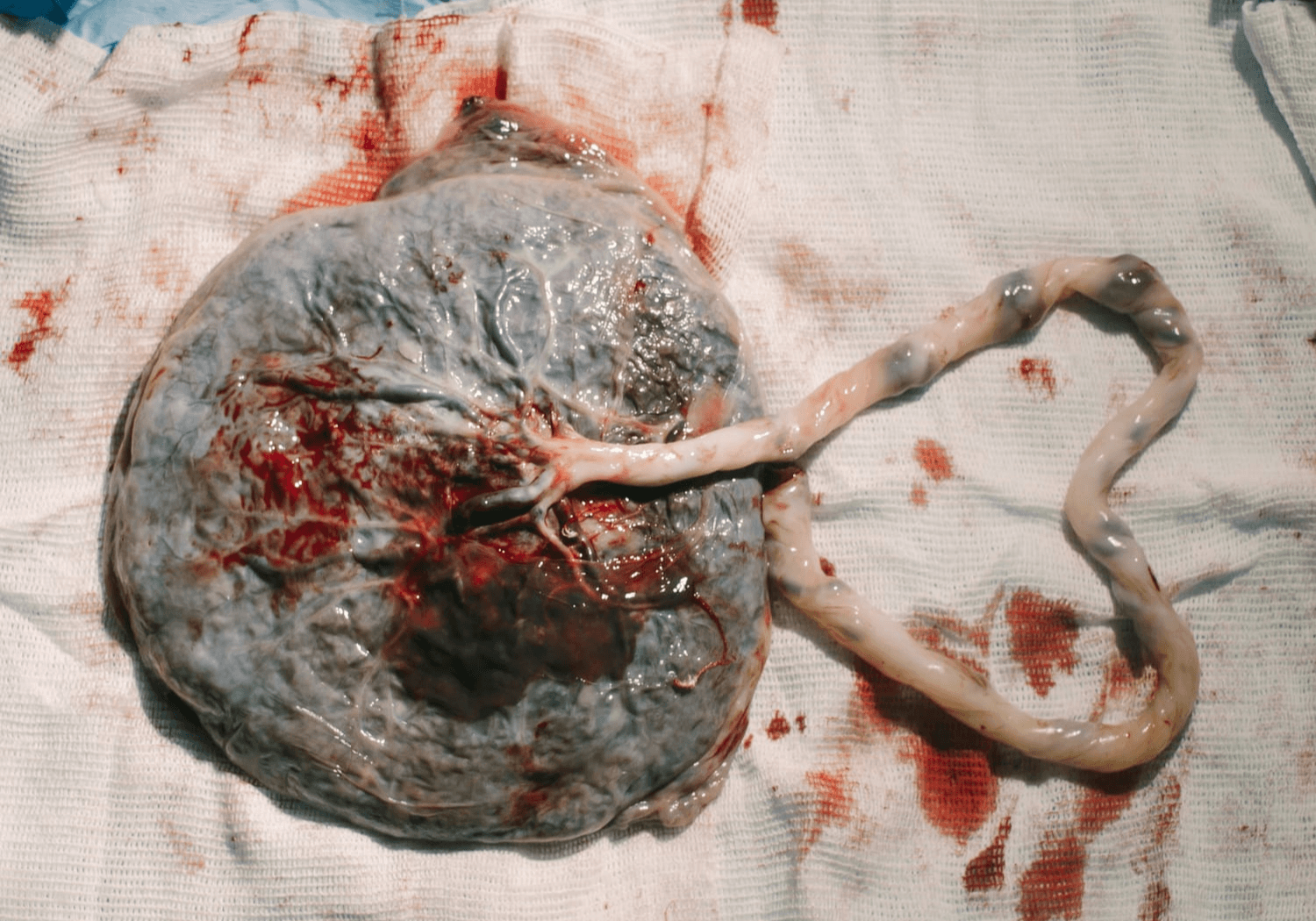 Honorer le placenta de ton bébé : rituels, symbolique et transformation après la naissance